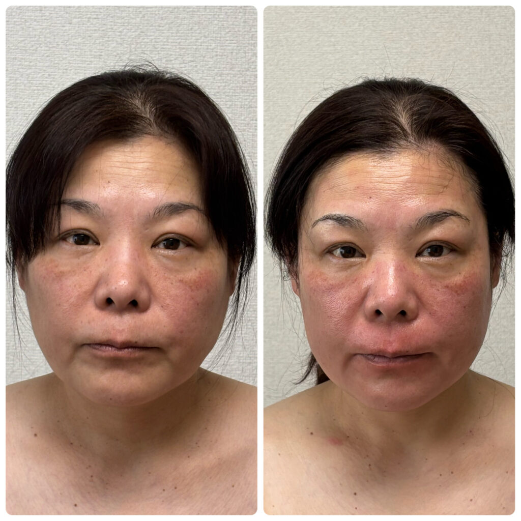 お客様　施術before/after