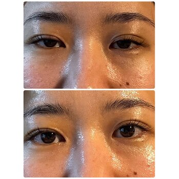 Before⇒After　目元パッチリ！！