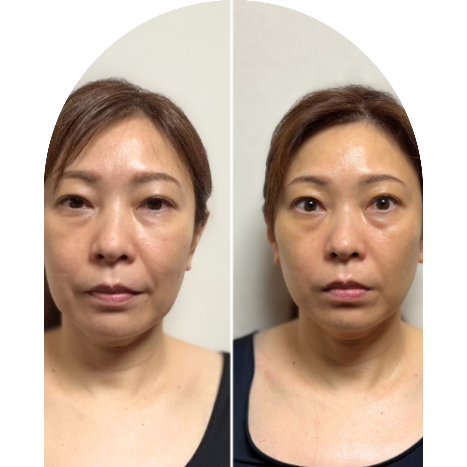 ビフォーアフターMENU