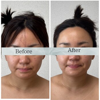 顔ジム　Before/After