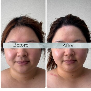 顔ジム　Before/After