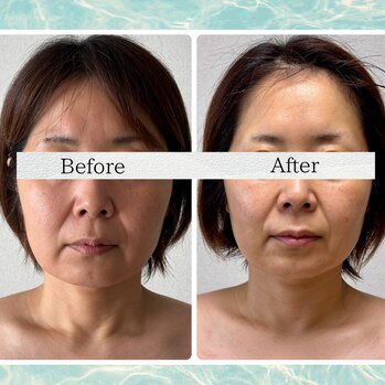 顔ジム　Before/After
