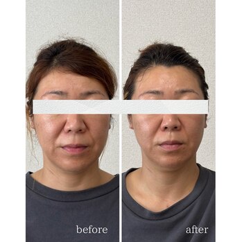 顔ジム　Before/After