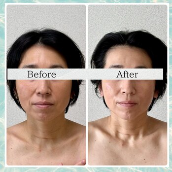顔ジム　Before:After5