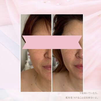 顔ジム初回のお客様　Before:After