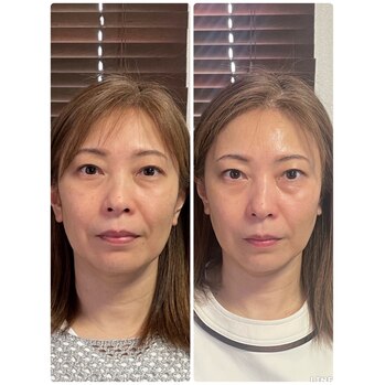 顔ジム見直し会