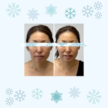 鹿児島からの顔ジムファンのお客様